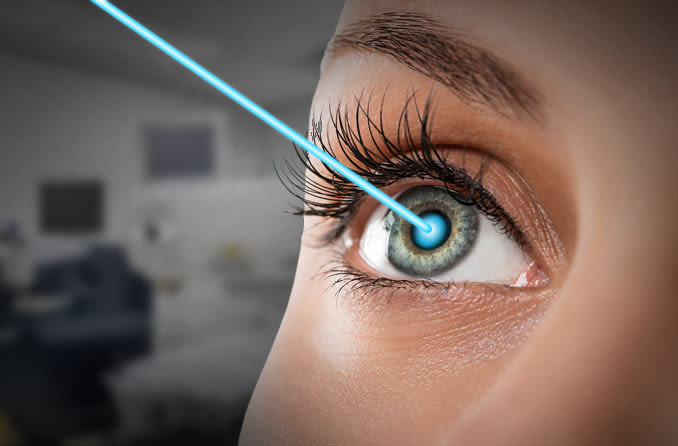 شرایط استفاده از بیمه تکمیلی برای لیزیک چشم
